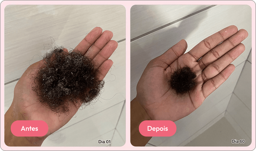antes e depois 1
