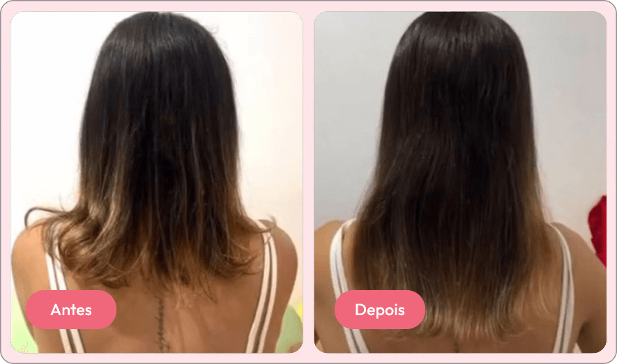 antes e depois 5
