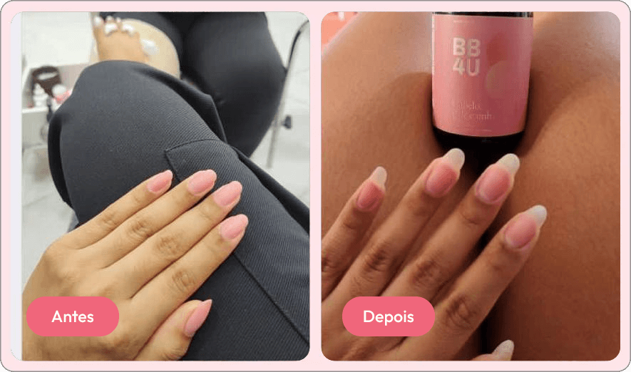 antes e depois 6
